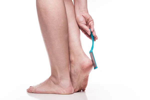 Care for dry skin on the well-groomed feet and heels with the he — 스톡 사진