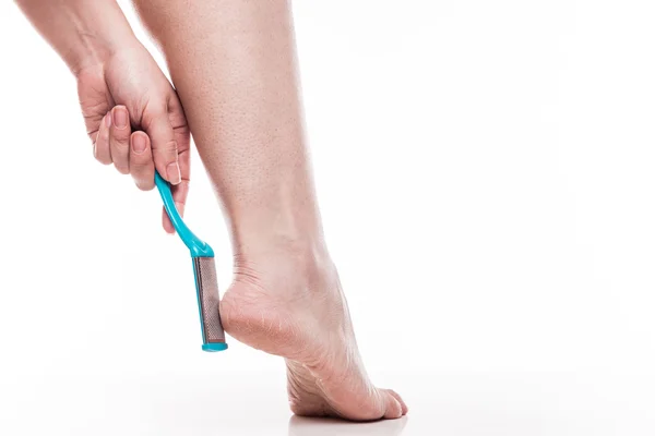 Догляд за сухою шкірою на доглянутих ногах і підборах з ним — стокове фото