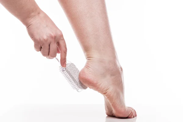 Догляд за сухою шкірою на доглянутих ногах і підборах з ним — стокове фото