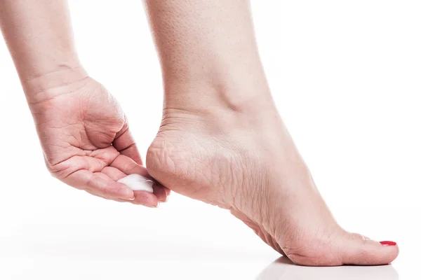 Zorg voor de droge huid op de goed verzorgde voeten en hakken met crèmes — Stockfoto