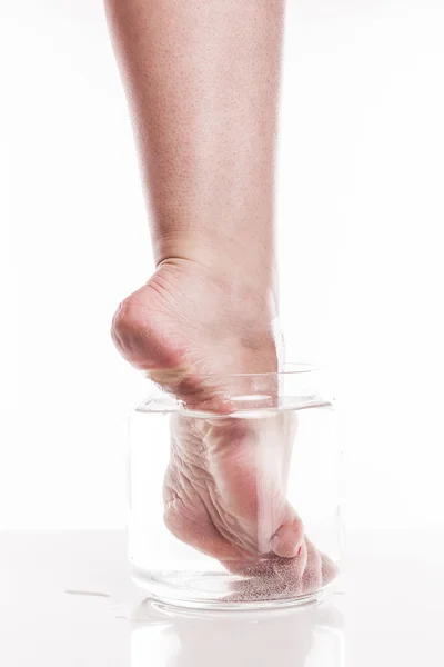 Foot girl with a dry and rough skin and calluses on the heel moi — Stock Photo, Image