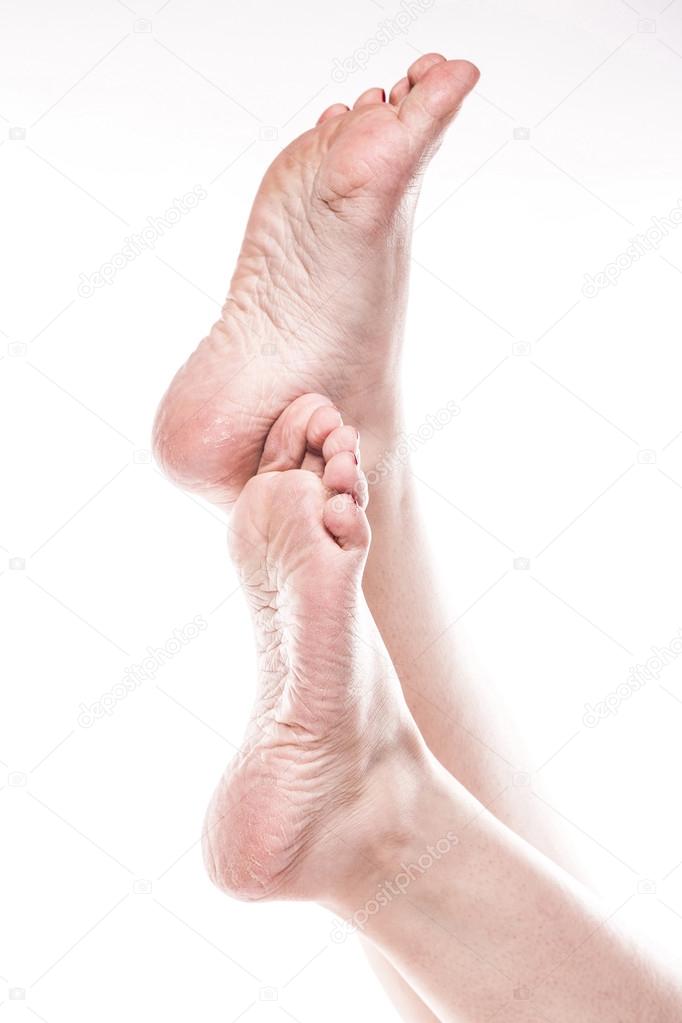 female foot with pedicure and poor over-dry skin on the heels of