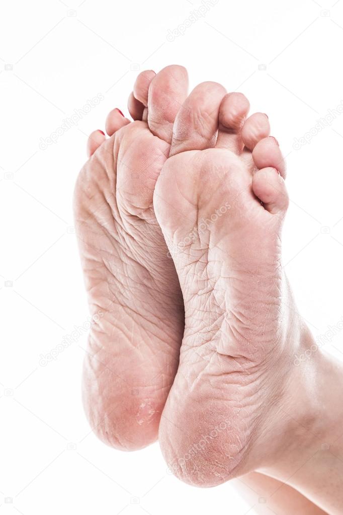 Crusty Feet