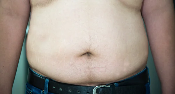 Fat male show his stomach — Stock Photo, Image