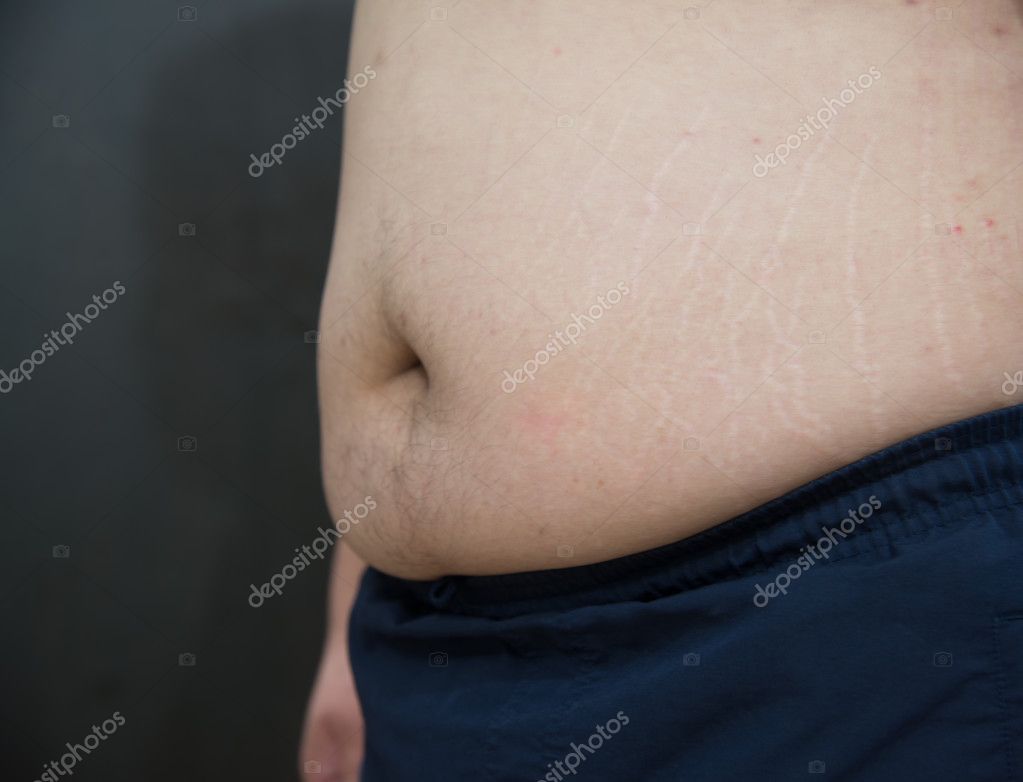 Acne online on stomach