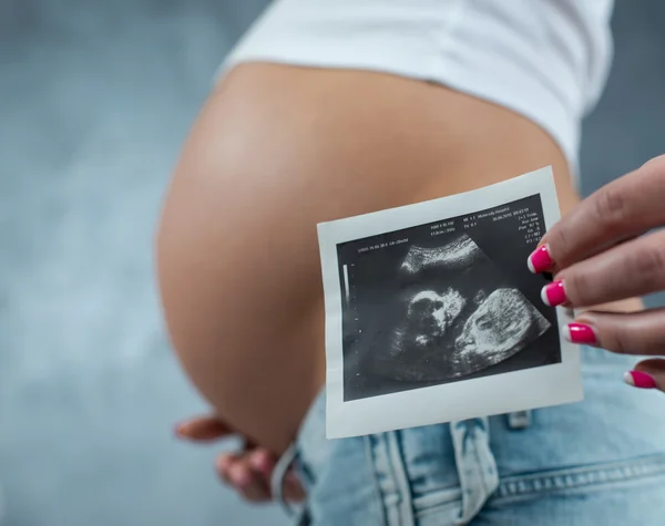 Close up van een schattig zwangere buik en echografie scannen van baby. P — Stockfoto