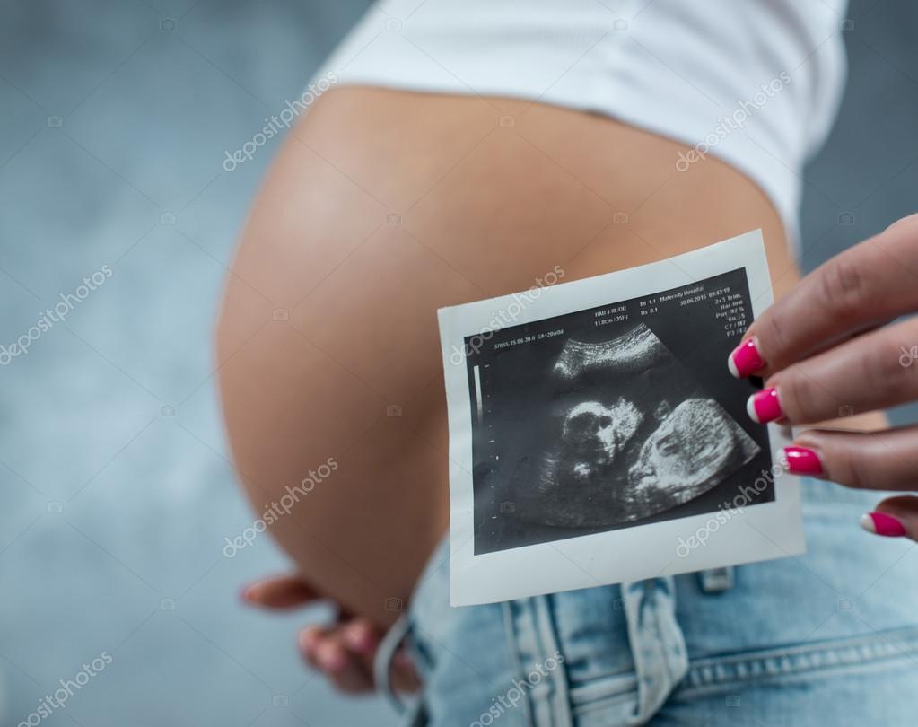 Gros Plan D Un Mignon Scan Enceinte De Ventre Et L Echographie De Bebe P Photographie Serge Gorenko C