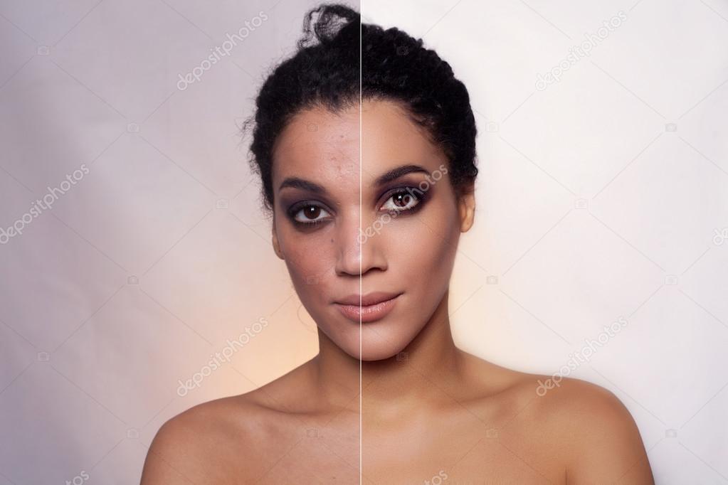 Before and after cosmetic operation. Young pretty woman portrait