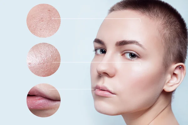 Skin beauty young woman before and after the procedure — Stock Photo, Image