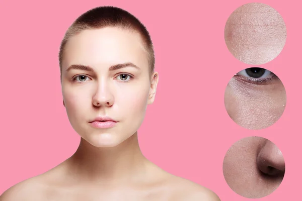 Beleza da pele jovem mulher antes e depois do procedimento — Fotografia de Stock