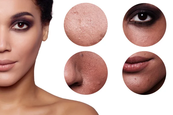 Skin beauty mladá žena před a po zákroku — Stock fotografie