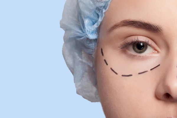 Schöne junge Frau Perforation Linien plastische Chirurgie Operation — Stockfoto