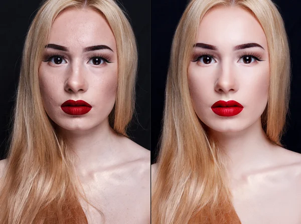 Antes e depois da operação cosmética. Jovem bonita mulher retrato — Fotografia de Stock