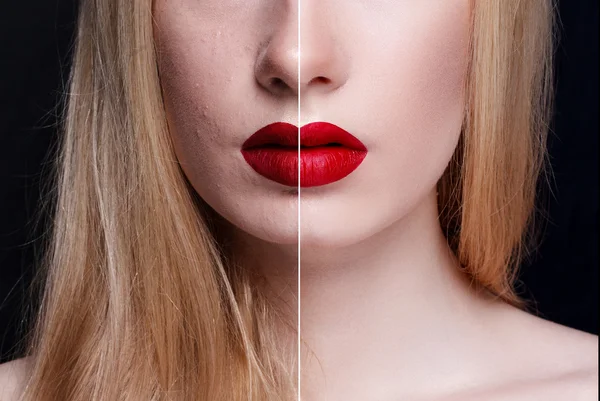 Antes e depois da operação cosmética. Jovem bonita mulher retrato — Fotografia de Stock