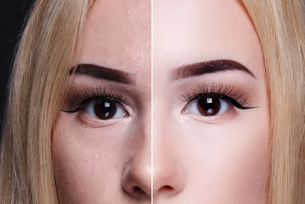 Antes e depois da operação cosmética. Jovem bonita mulher retrato — Fotografia de Stock