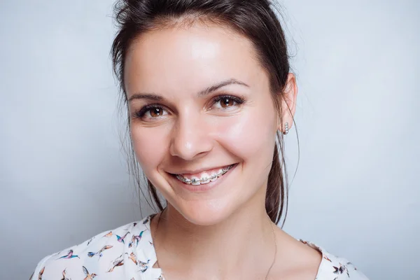 Retrato de mujer joven con tirantes dentales naturales — Foto de Stock