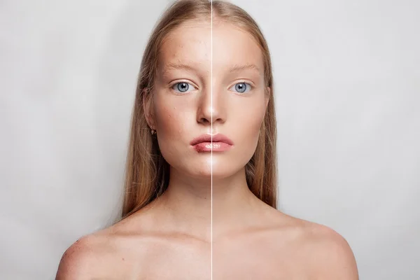 Prima e dopo l'operazione cosmetica. Giovane bella donna ritratto — Foto Stock