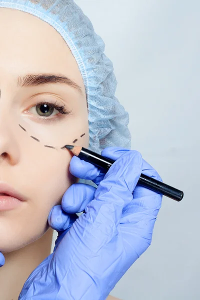 Mooie jonge vrouw perforatie lijnen plastische chirurgie operatio — Stockfoto