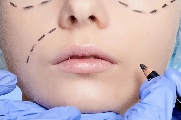 Schöne junge Frau Perforationslinien plastische Chirurgie operatio — Stockfoto