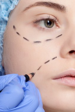 Güzel ve genç birbayan delikli çizgiler plastik cerrahi operatio