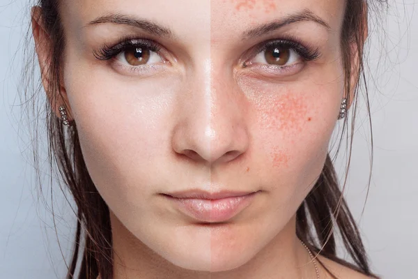 Antes y después de la operación cosmética. Joven mujer bonita retrato — Foto de Stock