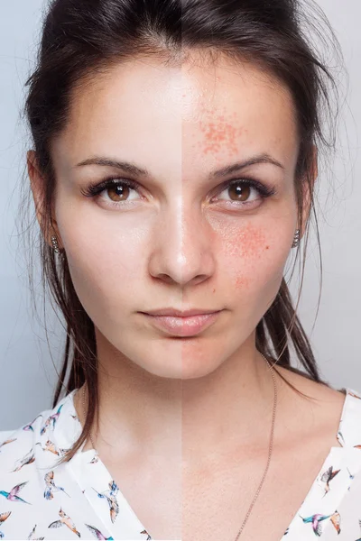 Before and after cosmetic operation. Young pretty woman portrait — Stock Photo, Image