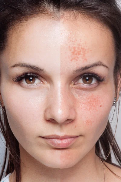 Před a po kosmetických operací. Mladá krásná žena portrét — Stock fotografie