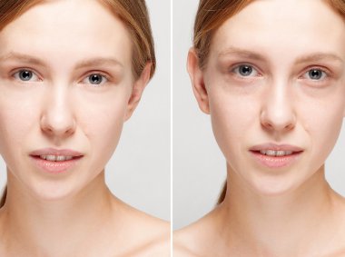 Önce ve sonra kozmetik işlemi.