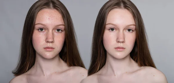 Santé Personnes Concept Jeunesse Beauté Visage Femme Avant Après Procédure — Photo