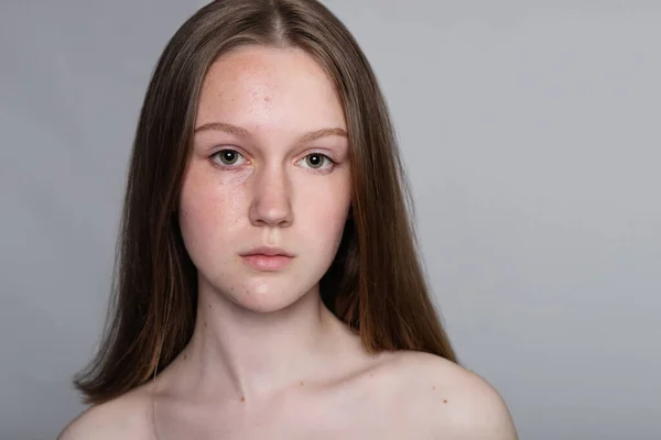 Nainen Kasvot Ennen Jälkeen Kosmeettinen Menettely Kasvojen Puhdistukseen — kuvapankkivalokuva