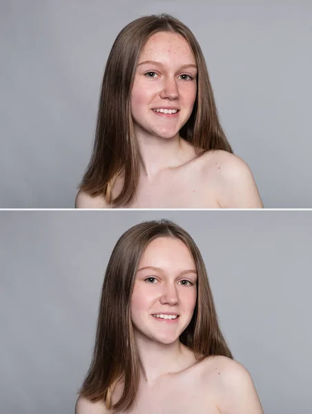 Saúde Pessoas Juventude Conceito Beleza Antes Depois Operação Cosmética Retrato — Fotografia de Stock