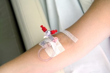 catheter in the arm clipart