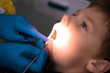 Diş kontrolü ya da diş tedavisi sırasında dişçi koltuğunda 7-11 ve doktorun elleri mavi eldivenli.