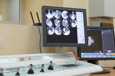 Anjiyografik çalışmaları için çalışma.