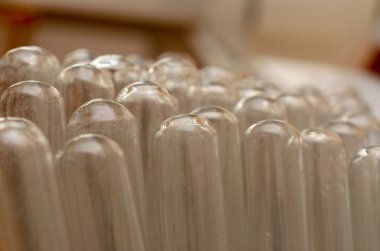 Tüpler biyokimyasal laboratuvar.