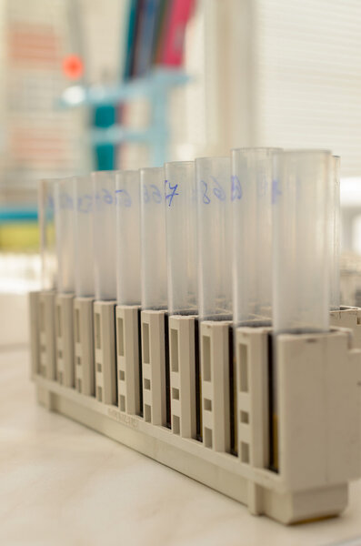 The tubes biochemical laboratory.