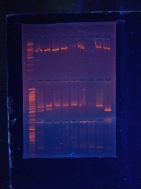 DNA tespiti için elektroforez jeli fotoğrafı
