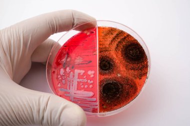 Petri kabında tarım medyasındaki mantarların büyümesinin fotoğrafı