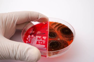 Petri kabında tarım medyasındaki mantarların büyümesinin fotoğrafı