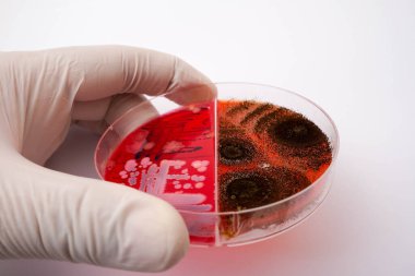 Petri kabında tarım medyasındaki mantarların büyümesinin fotoğrafı