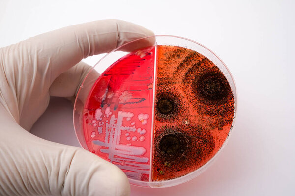 photo of fungi growth on agar media in petri dish