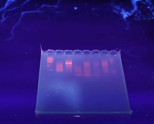 DNA bantları agarose jel plaka üzerinde