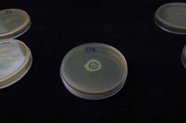 kontakt lens etrafındaki yapışkanlığı test etmek için agar plakadaki bakteriyel büyüme