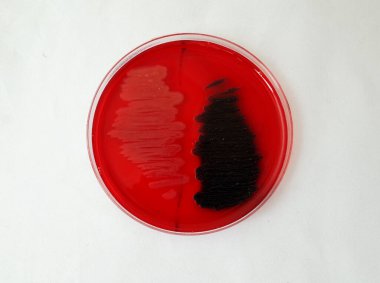 bacterial gowth on Congo red agar plate to test the ability of bacteria to broduce biofilm clipart