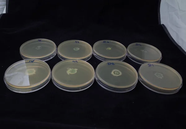 Crescimento Bacteriano Placa Ágar Para Testar Capacidade Adesão Torno Lente — Fotografia de Stock