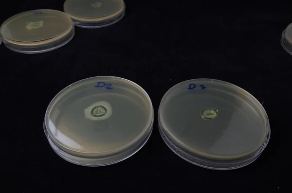 Crecimiento Bacteriano Placa Agar Para Probar Capacidad Adhesión Alrededor Lente — Foto de Stock