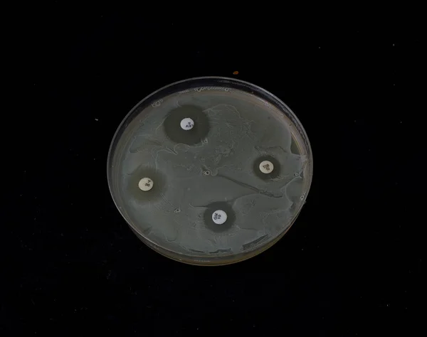 Crescimento Bactérias Ágar Com Discos Antibióticos Para Testar Susceptibilidade Das — Fotografia de Stock