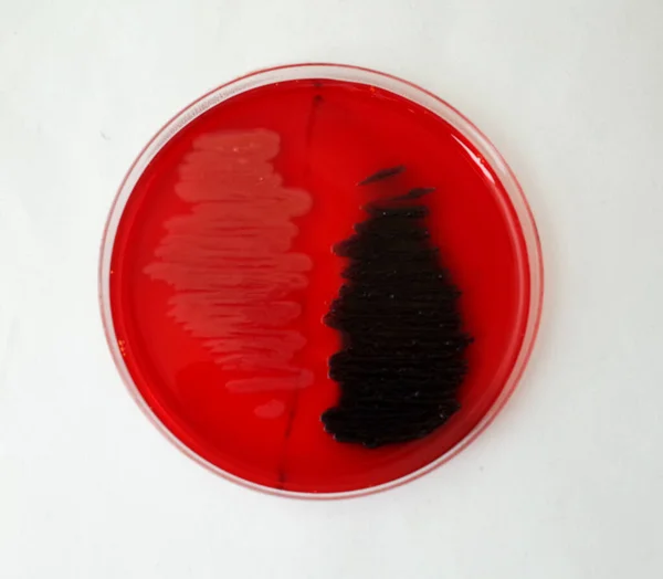 Червоний Жир Червоній Агарній Пластині Конго Перевірки Здатності Бактерій Розпускати — стокове фото