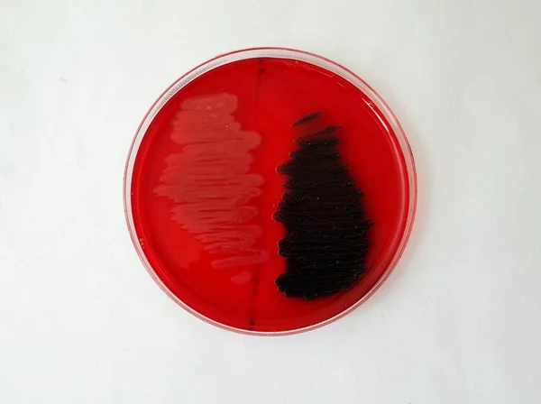 Bacterial Gowth Congo Red Agar Plate Test Ability Bacteria Broduce — Stock Photo, Image