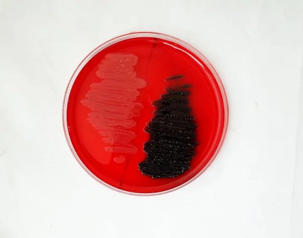 Червоний Жир Червоній Агарній Пластині Конго Перевірки Здатності Бактерій Розпускати — стокове фото